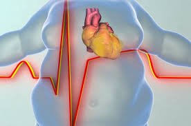 Why Obesity is the measure cause of heart attack?