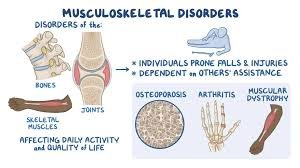 What are the types of treatment and common symptoms for musculoskeletal disorders?